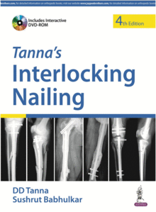 TANNA'S INTERLOCKING NAILING + DVD. 4TH EDITION