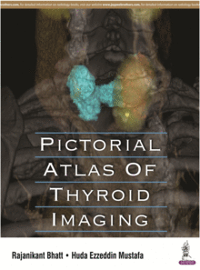 PICTORIAL ATLAS OF THYROID IMAGING
