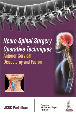 NEURO SPINAL SURGERY OPERATIVE TECHNIQUES. ANTERIOR CERVICAL DISCECTOMY AND FUSION