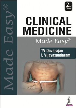 CLINICAL MEDICINE MADE EASY. 2ND EDITION
