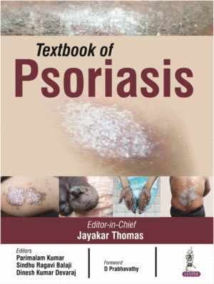 TEXTBOOK OF SORIASIS