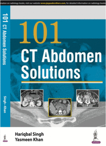 101 CT ABDOMEN SOLUTIONS