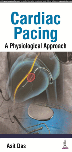 CARDIAC PACING. A PHYSIOLOGICAL APPROACH