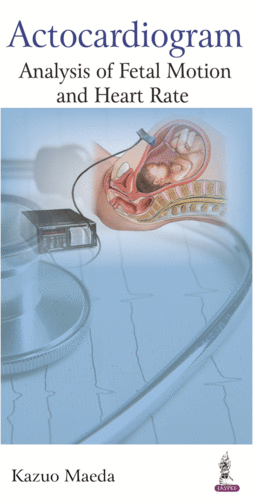 ACTOCARDIOGRAM. ANALYSIS OF FETAL MOTION AND HEART RATE
