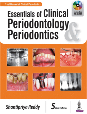 ESSENTIALS OF CLINICAL PERIODONTOLOGY AND PERIODONTICS + CD-ROM. 5TH EDITION