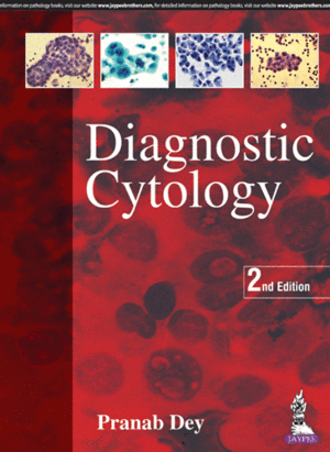 DIAGNOSTIC CYTOLOGY. 2ND EDITION