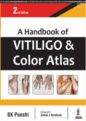 A HANDBOOK OF VITILIGO AND COLOR ATLAS. 2ND EDITION