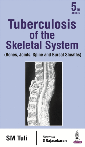 TUBERCULOSIS OF THE SKELETAL SYSTEM. 5TH EDITION