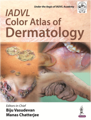 IADVL COLOR ATLAS OF DERMATOLOGY
