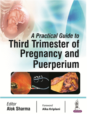 A PRACTICAL GUIDE TO THIRD TRIMESTER OF PREGNANCY & PUERPERIUM