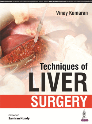 TECHNIQUES OF LIVER SURGERY
