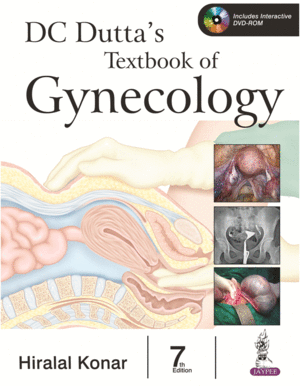 DC DUTTA'S TEXTBOOK OF GYNECOLOGY. 7TH EDITION. INCLUDE INTERACTIVE DVD-ROM