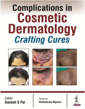 COMPLICATIONS IN COSMETIC DERMATOLOGY