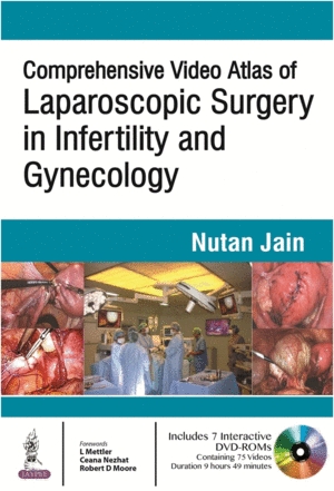 COMPREHENSIVE VIDEO ATLAS OF LAPAROSCOPIC SURGERY IN INFERTILITY AND GYNECOLOGY + DVD