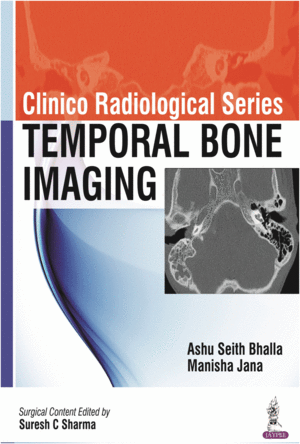 TEMPORAL BONE IMAGING. CLINICO RADIOLOGICAL SERIES