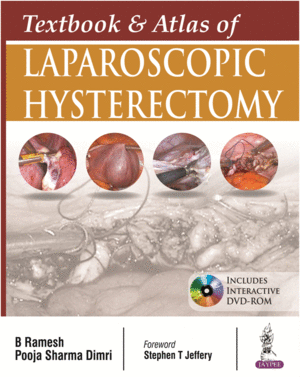 TEXTBOOK AND ATLAS OF LAPAROSCOPIC HYSTERECTOMY. INCLUDES INTERACTIVE DVD-ROM