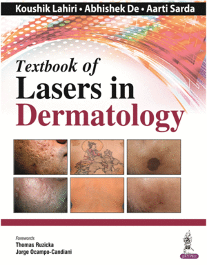 TEXTBOOK OF LASERS IN DERMATOLOGY