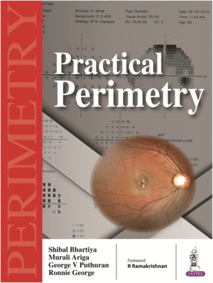 PRACTICAL PERIMETRY