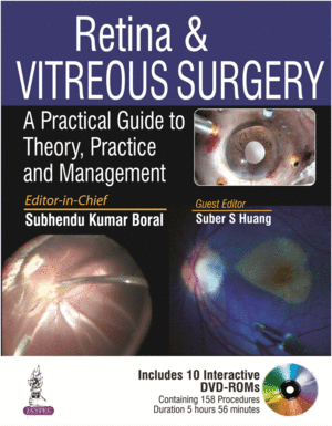 RETINA AND VITREOUS SURGERY. INCLUDES 10 INTERACTIVE DVD-ROM`S