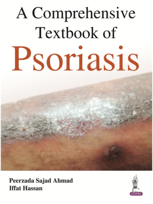 A COMPREHENSIVE TEXTBOOK OF PSORIASIS
