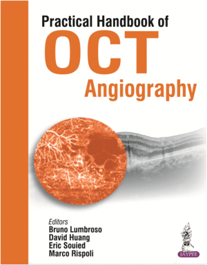 PRACTICAL HANDBOOK OF OCT ANGIOGRAPHY