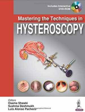 MASTERING THE TECHNIQUES IN HYSTEROSCOPY + DVD