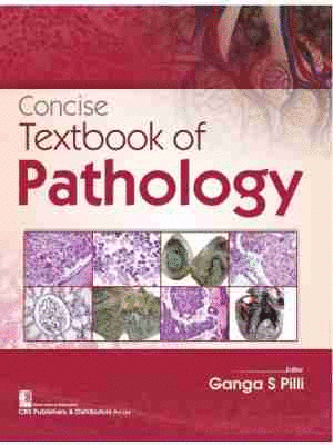 CONCISE TEXTBOOK OF PATHOLOGY