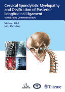 CERVICAL SPONDYLOTIC MYELOPATHY AND OSSIFICATION OF POSTERIOR LONGITUDINAL LIGAMENT. WFNS SPINE COMMITTEE BOOK