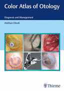 COLOR ATLAS OF OTOLOGY. DIAGNOSIS AND MANAGEMENT