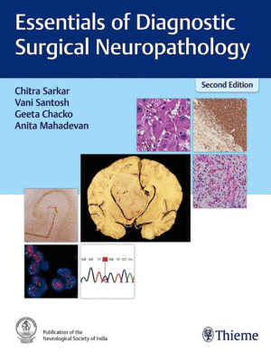 ESSENTIALS OF DIAGNOSTIC SURGICAL NEUROPATHOLOGY. 2ND EDITION