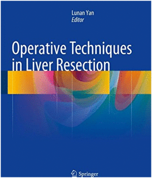 OPERATIVE TECHNIQUES IN LIVER RESECTION