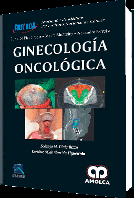 GINECOLOGIA ONCOLOGICA