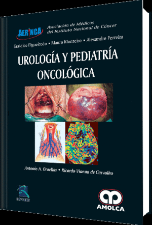 UROLOGIA Y PEDIATRIA ONCOLOGICA
