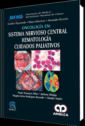 ONCOLOGIA EN SISTEMA NERVIOSO CENTRAL, HEMATOLOGIA, CUIDADOS PALIATIVOS
