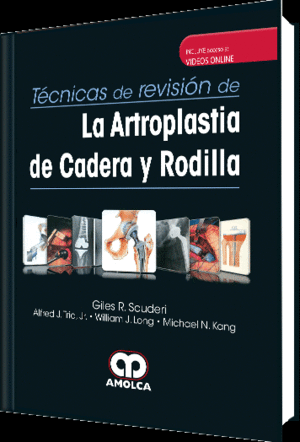 TECNICAS DE REVISION DE LA ARTROPLASTIA DE CADERA Y RODILLA + VIDEOS ONLINE