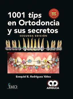 1001 TIPS EN ORTODONCIA Y SUS SECRETOS. 2 EDICIN