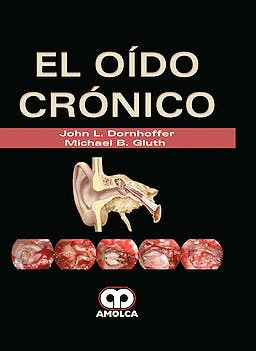 EL O�DO CR�NICO