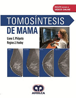 TOMOSNTESIS DE MAMA + VIDEOS ONLINE