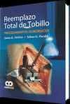 REEMPLAZO TOTAL DE TOBILLO. PROCEDIMIENTOS QUIRURGICOS