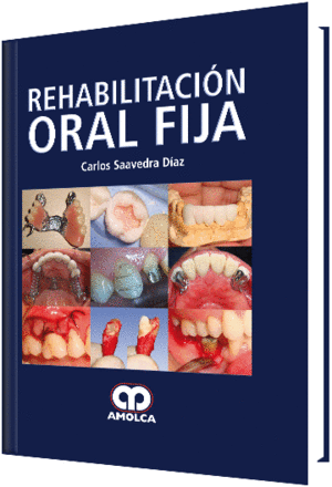 REHABILITACION ORAL FIJA