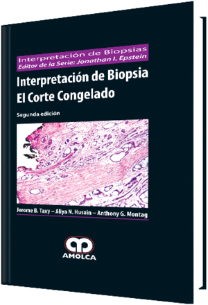 INTERPRETACION DE BIOPSIA. EL CORTE CONGELADO. 2� EDICI�N