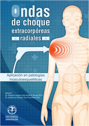 ONDAS DE CHOQUE EXTRACORP�REAS RADIALES. APLICACI�N EN PATOLOG�AS M�SCULOESQUELETICAS