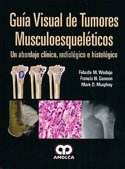 GU�A VISUAL DE TUMORES MUSCULOESQUEL�TICOS. UN ABORDAJE CL�NICO, RADIOL�GICO E HISTOL�GICO