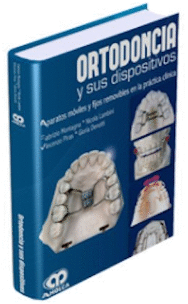 ORTODONCIA Y SUS DISPOSITIVOS