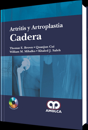 ARTRITIS Y ARTROPLASTIA: CADERA + DVD