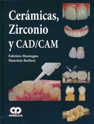 CERAMICAS DE ZIRCONIO Y CAD-CAM