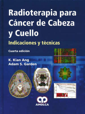 RADIOTERAPIA PARA CANCER DE CABEZA Y CUELLO. INDICACIONES Y TECNICAS. 4� EDICI�N