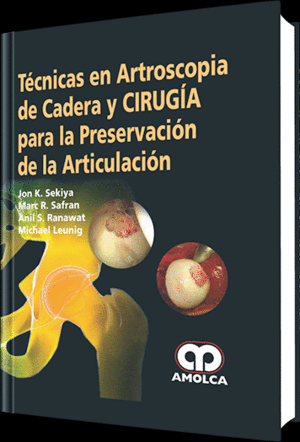 TECNICAS EN ARTROSCOPIA DE CADERA Y CIRUGIA PARA LA PRESERVACION DE LA  ARTICULACION