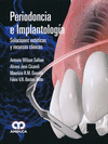 PERIODONCIA E IMPLANTOLOGIA. SOLUCIONES ESTETICAS Y RECURSOS CLINICOS