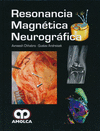 RESONANCIA MAGNETICA NEUROGRAFICA